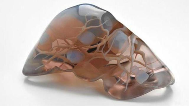 Primer Hígado Bioartificial