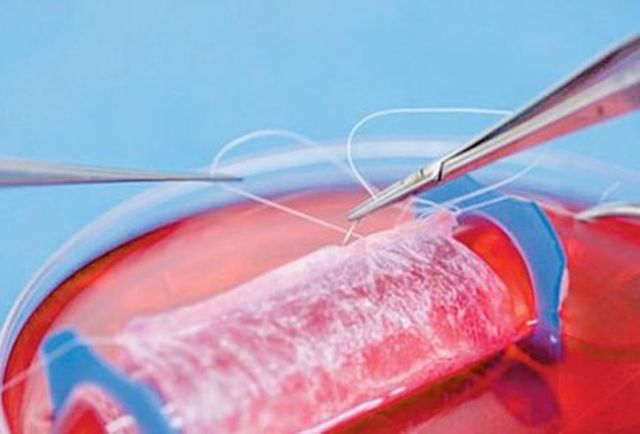 Ingenieria de Tejidos