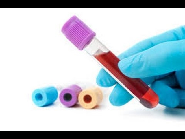 Blood Test