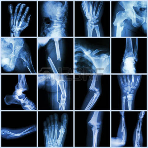 W. C. Roenteng descubre los rayos X