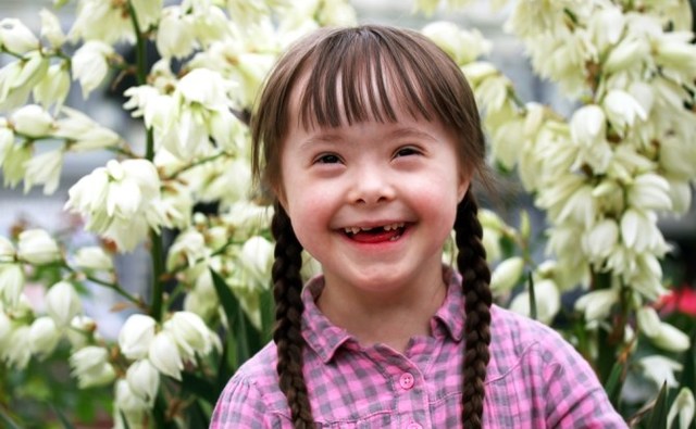 El síndrome de Down