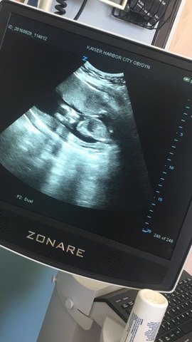 My mother was pregnant