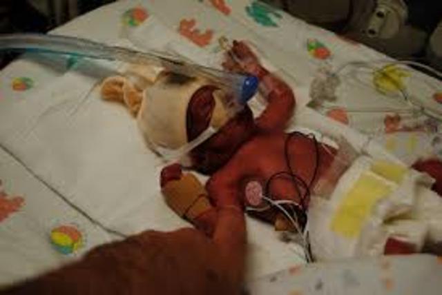 I was Pre-Mature baby when i was born