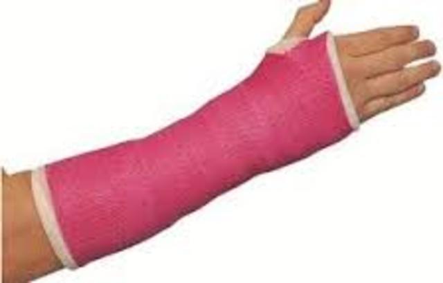 The time I fractured my wrist