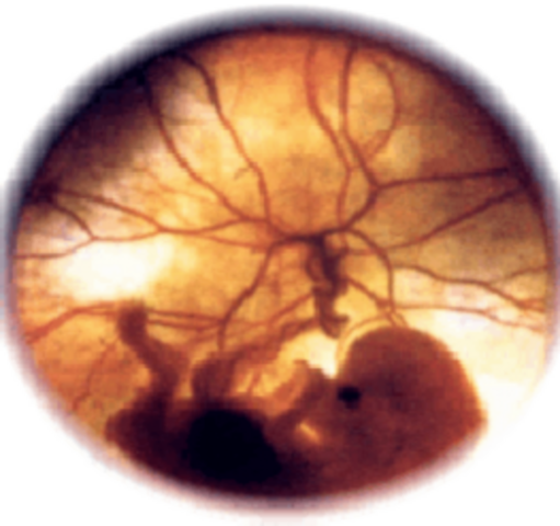 Período Embrionario