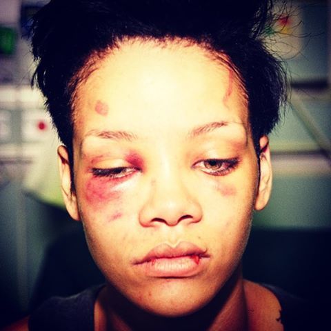 Rihanna gets assaulted