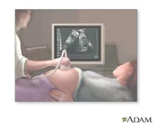 Ultrasounds Invented