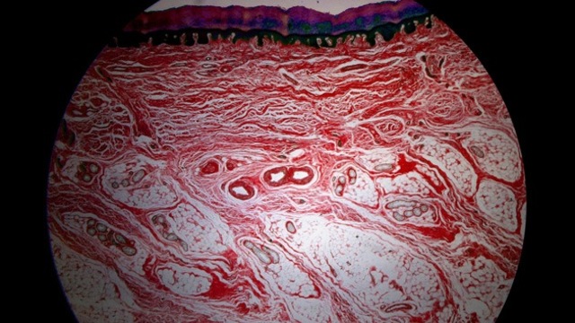 Células madres a partir de piel humana