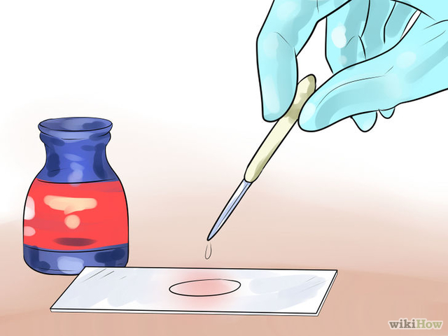 Invención de la tinción