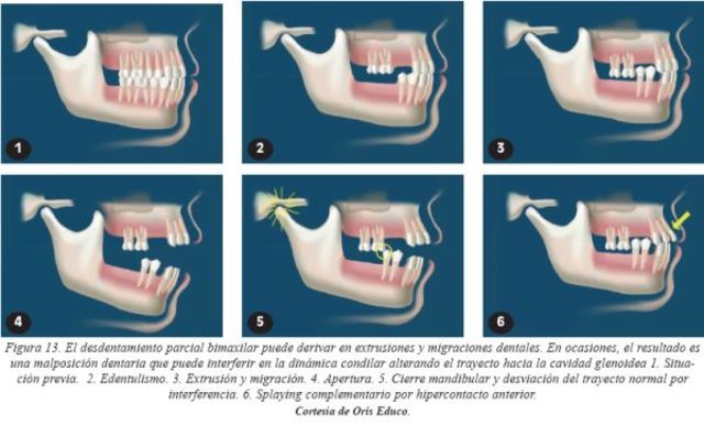 1991 Kerstein y Wrigth