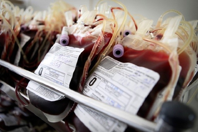 Blood Transfusions