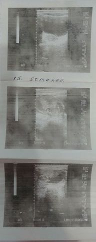 MI MAMÁ QUEDO EMBARAZADA