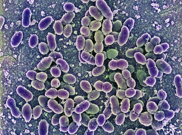 Se patentó en Inglaterra el antibiótico nicina para el uso en ciertos quesos fundidos con el fin de controlar los defectos ocasionados por clostridios.