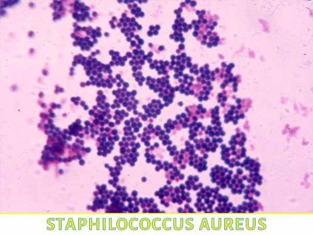 En Vernon sucedió una serie de brotes toxiinfectivos causados por Staphylococcus aureus.