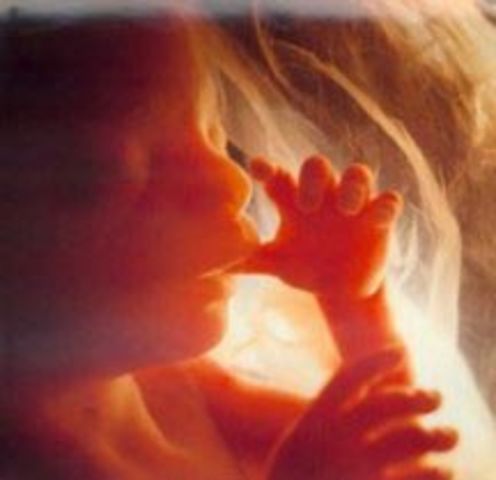 Período Fetal - 9-13 semanas