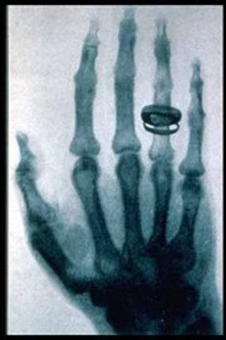 X-rays