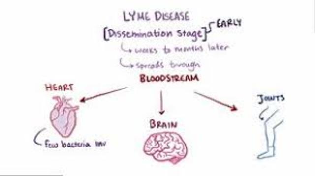 Lyme disease