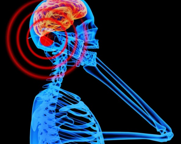 2.Utilizar el teléfono móvil favorece la aparición de cáncer