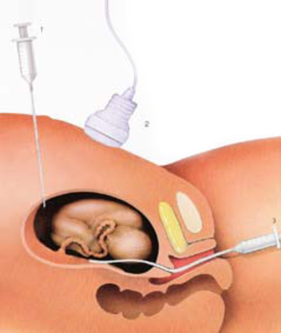 INVENCIONES Y AVANCES TECNOLÓGICOS DEL SIGLO XXI