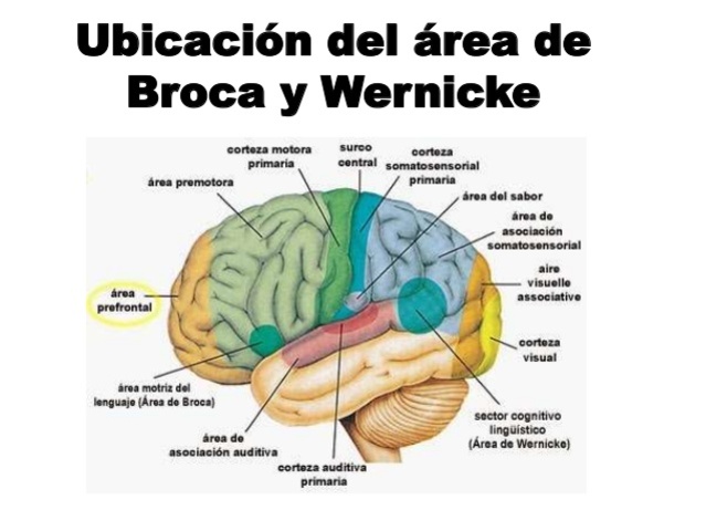 Alteraciones lenguaje oral