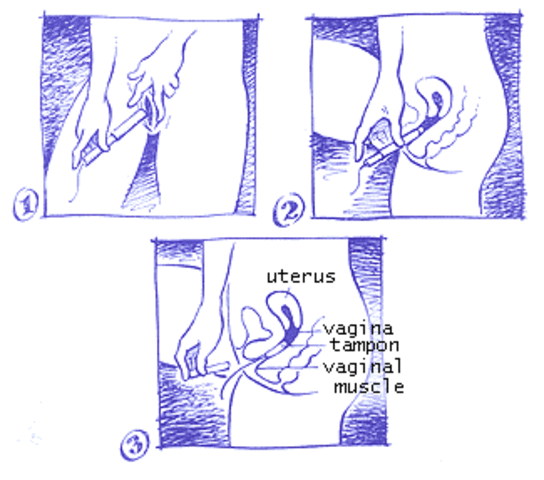The usage of Tampons