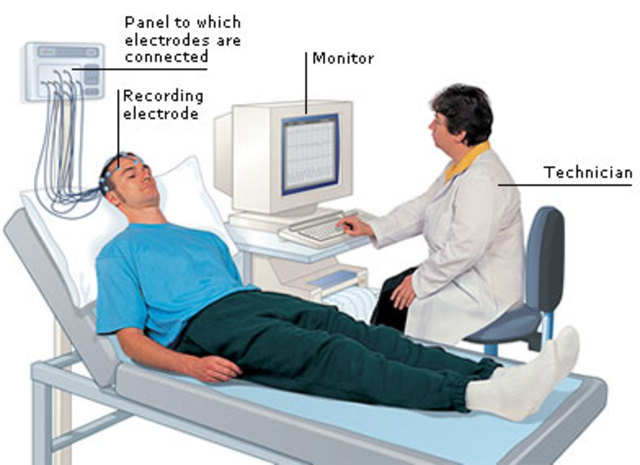 Electroencephalogram is Invented