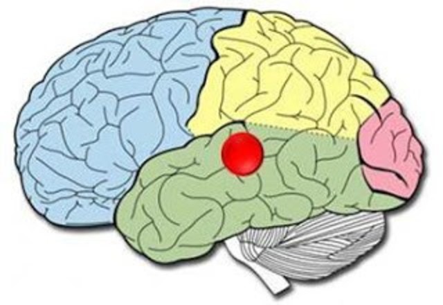 Área especifica de las dificultades del aprendizaje