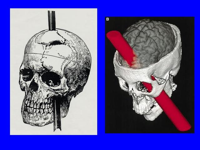 Phinea's Gage