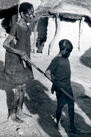 Programa de Lucha contra la Oncocercosis