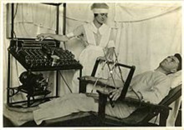 Electro-convulsive Therapy Begun