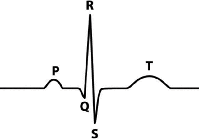 EKG