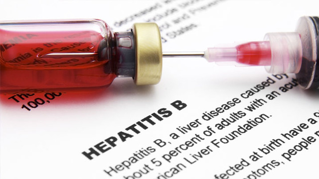 Hepatitis B