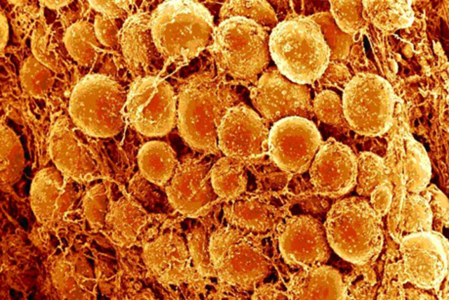 Anti-Bodies Attach To Cells in the Body