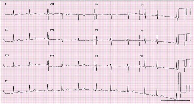 founding of electrocardiography