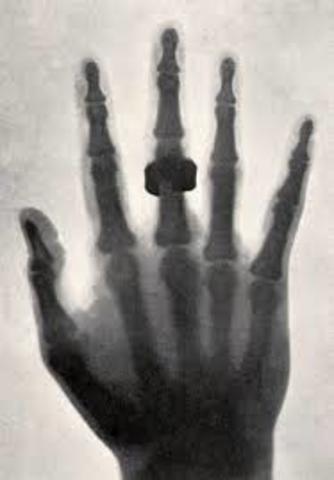 X-rays are discovered.