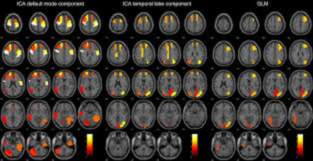 Sistema para uso en seres humanos de resonancia magnética