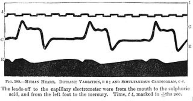 Registro de corriente electrica en el corazon humano