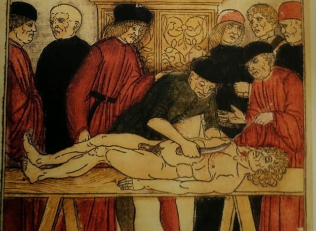 MONDINO DE LUZZI ( 1275- 1326)