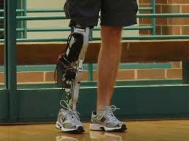 prosthetic leg