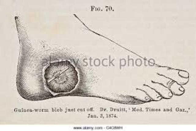 Guinea worm eradicated from the globe