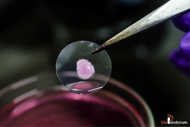 A "mini-liver"—the size of a small coin—is generated from human cord blood stem cells by doctors at Newcastle University, U.K.