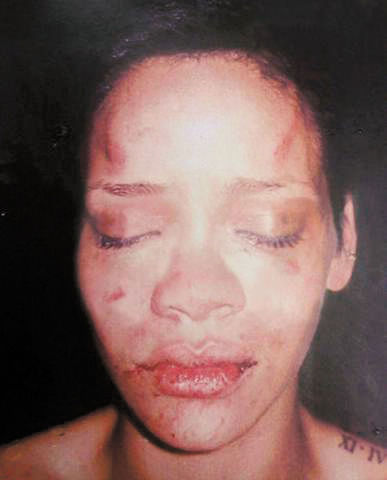Golpeada por su pareja (Chris Brown)