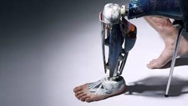 Bionic Limbs