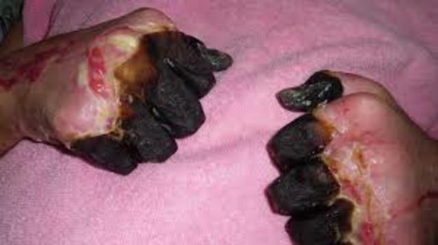 First vaccine was released for Bubonic Plague