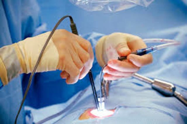 Minimally Invasive Surgery