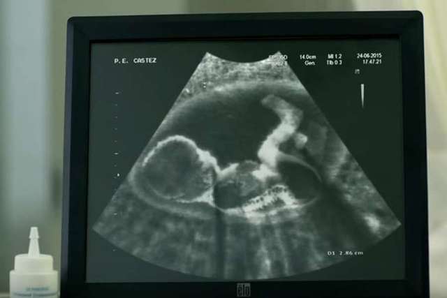 Commercial Ultrasound