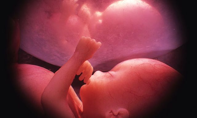 Primer nacimiento asistido de un humano