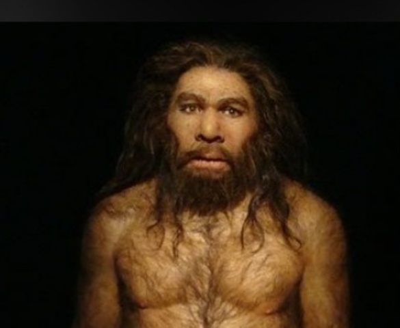 dientes desalineados