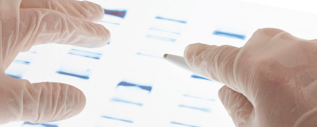 DIAGNOSTICO PRENATAL