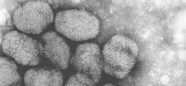 Smallpox declared eradicated